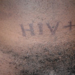 hiv-
