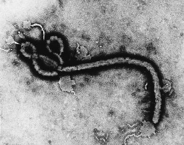 ebola