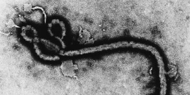 Ebola