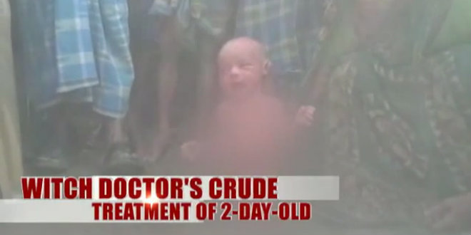 witch doctor force two day old baby to walk