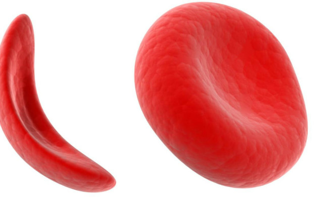 Female SCD warriors, Expensive Stuff?