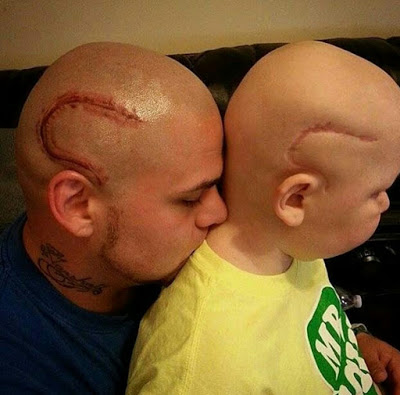 Amazing! Man tattoos his son's scar on his head to boost son's confidence