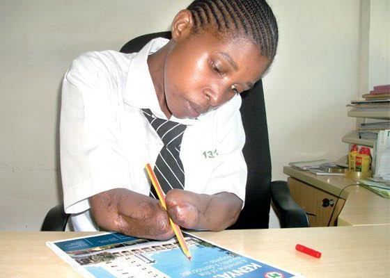High School Student Whose Arms Were Chopped Off By Her Boyfriend Learns to Live Again