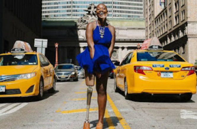 Amputee Woman Becomes Famous Fashion Blogger - elsieisy blog